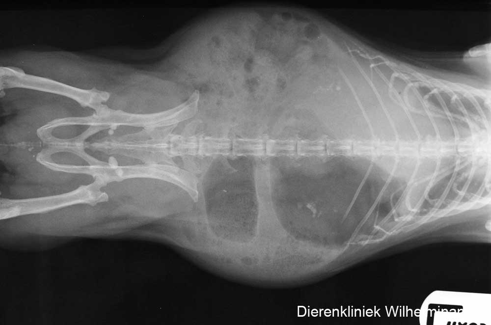 Op de rntgenfoto zijn 4 uretesteen te zien en calcificaties in de nier